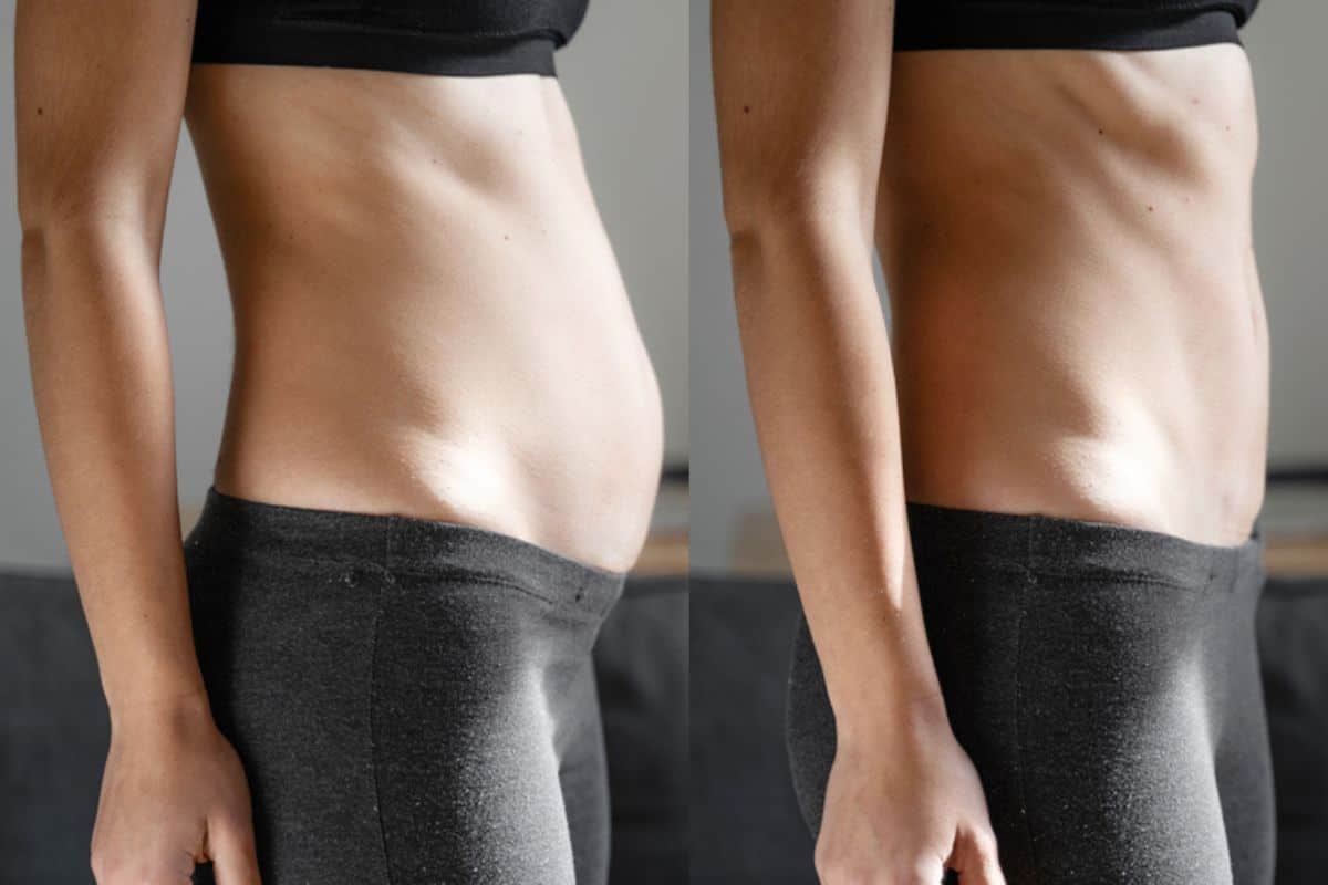 Post-Pregnancy: What Happens to Your Abdominal Muscles After Birth Upper Walthamstow