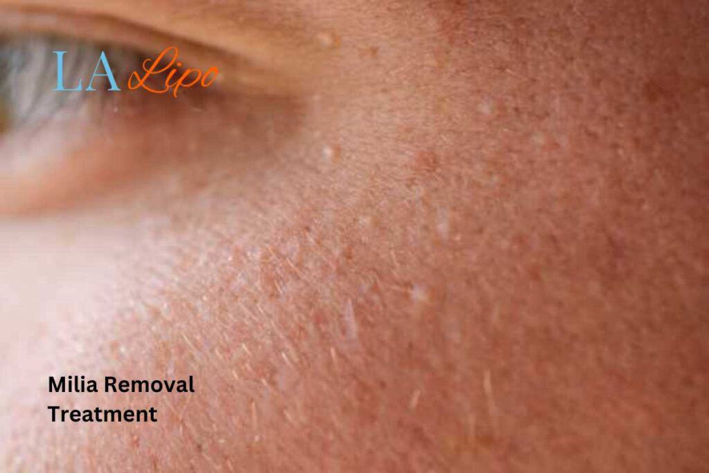 When It’s Time to See a Professional Upper Walthamstow?