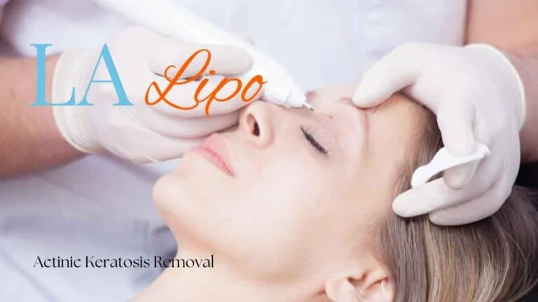Woman receiving Actinic Keratosis Removal Treatment Upper Walthamstow