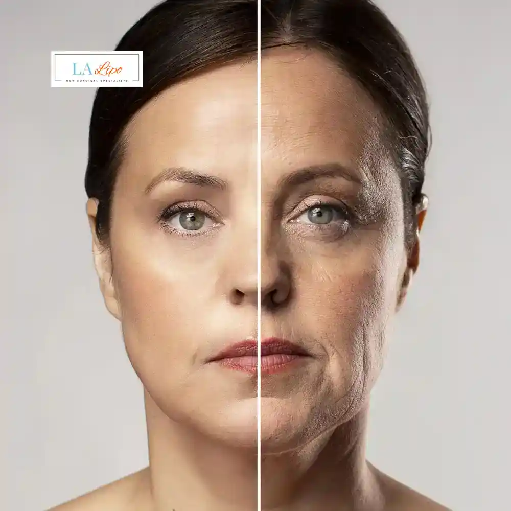 How Can You Tell If Non-Surgical Skin Tightening Is Right for You Upper Walthamstow?