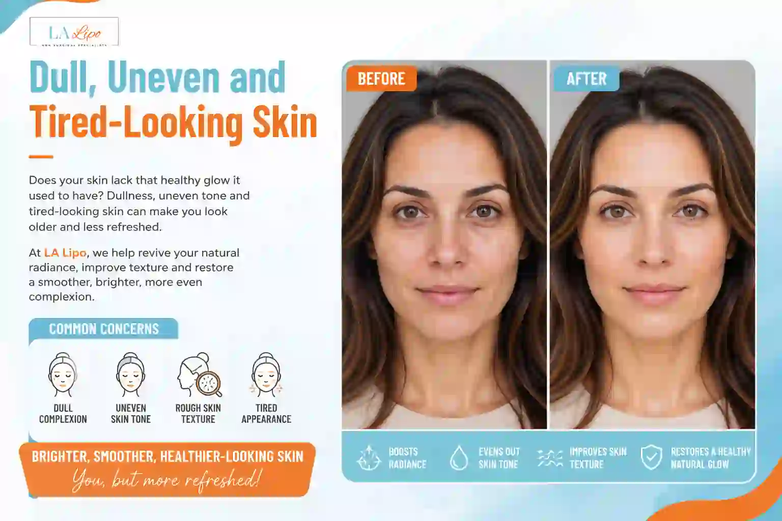 Sign #5: Dull, Uneven and Tired-Looking Skin Upper Walthamstow