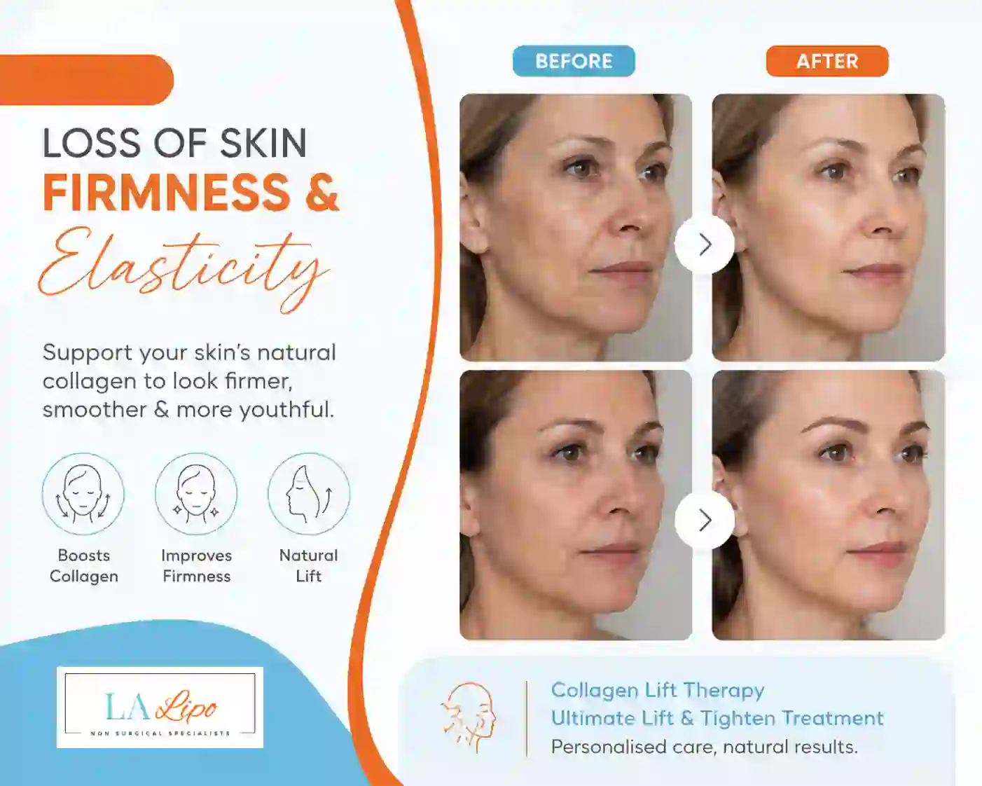 Sign #7: Loss of Skin Firmness and Elasticity Upper Walthamstow