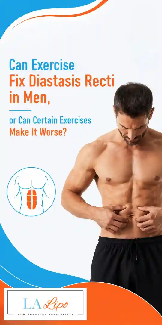 Can Exercise Fix Diastasis Recti in Men, or Can Certain Exercises Make It Worse Upper Walthamstow?