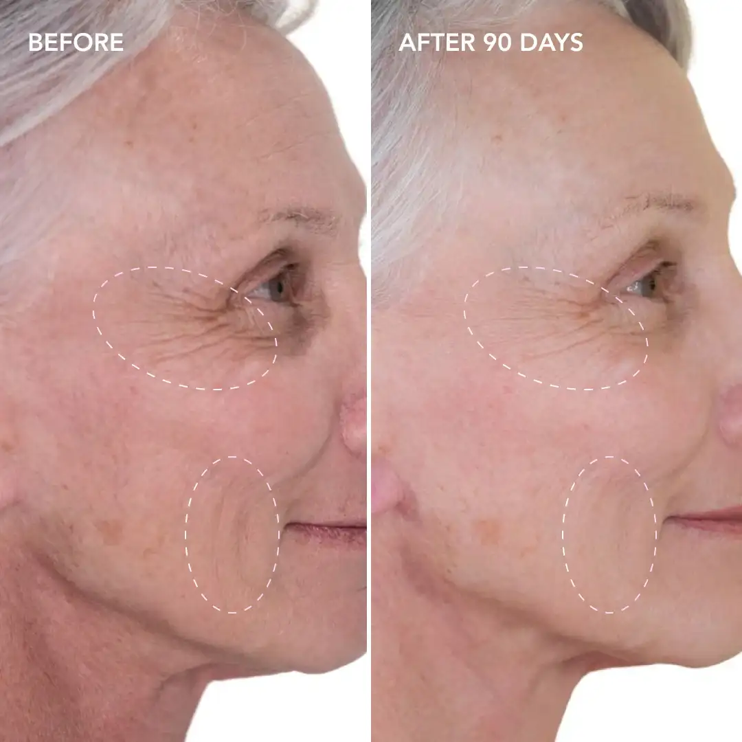 When will you see results Upper Walthamstow